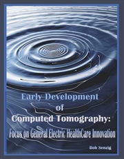 Buy Early Development of Computed Tomography: