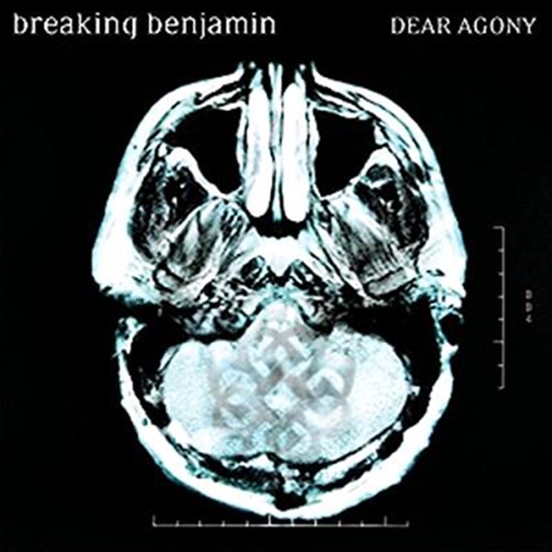 Dear Agony/Product Detail/Metal